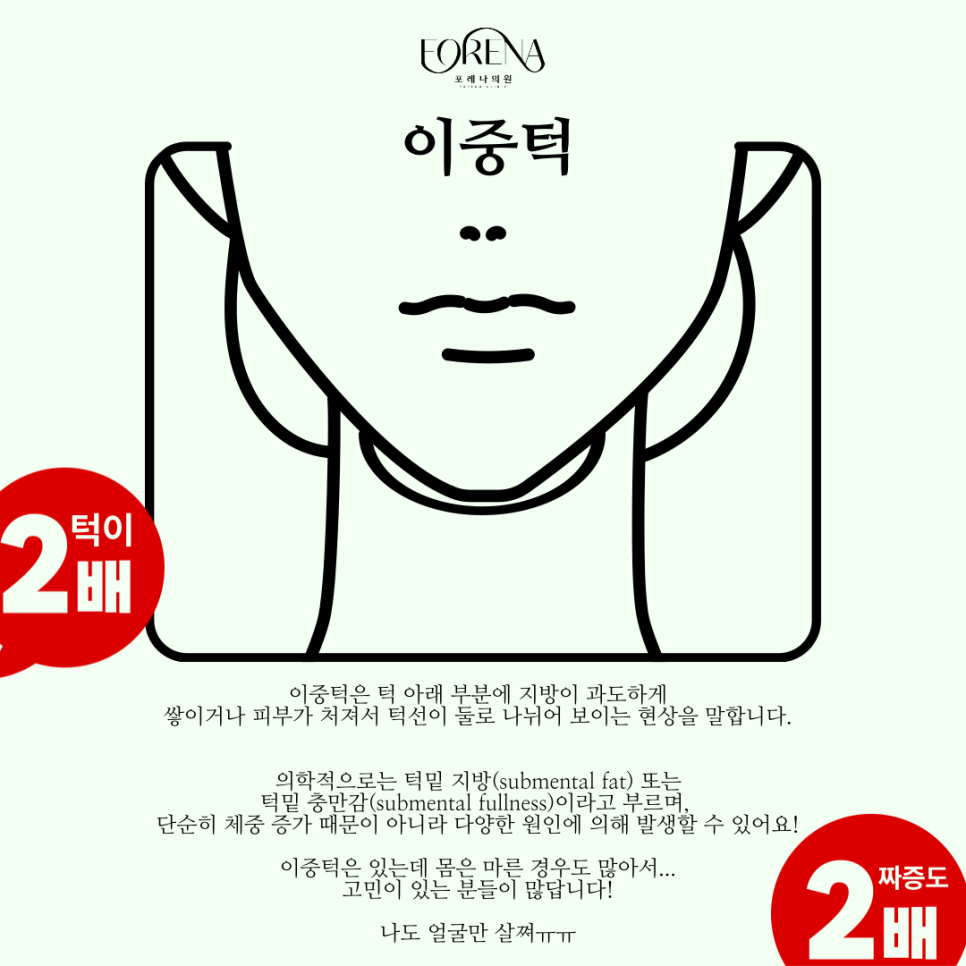 이중턱에 대한 자세한 내용부터 뮤잉 운동까지 알아보자! 관련 이미지 3