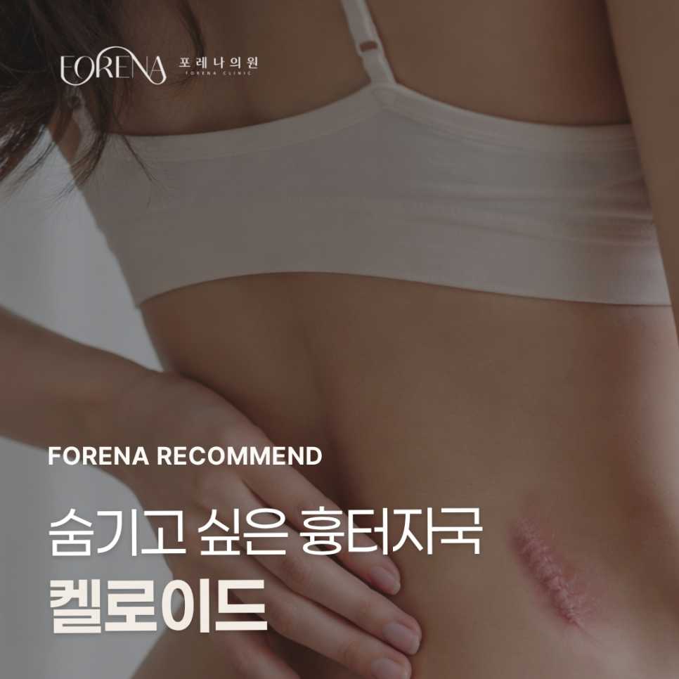 숨기고 싶은 흉터 자국 관련 이미지 1