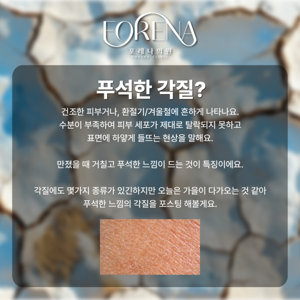 Worried About Flaky Skin During the Fall Seasonal Transition? image 3