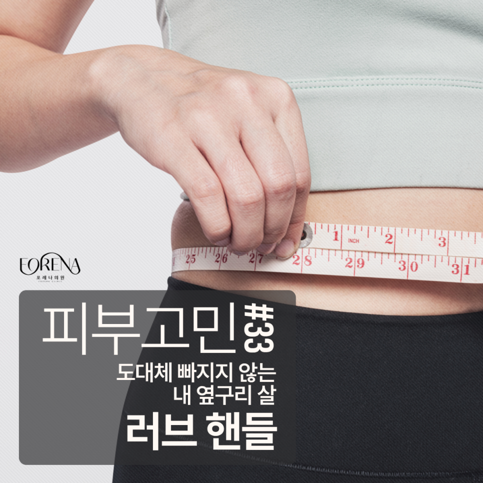 피부과에서 알려주는 러브 핸들과 이별하는 방법 관련 이미지 2