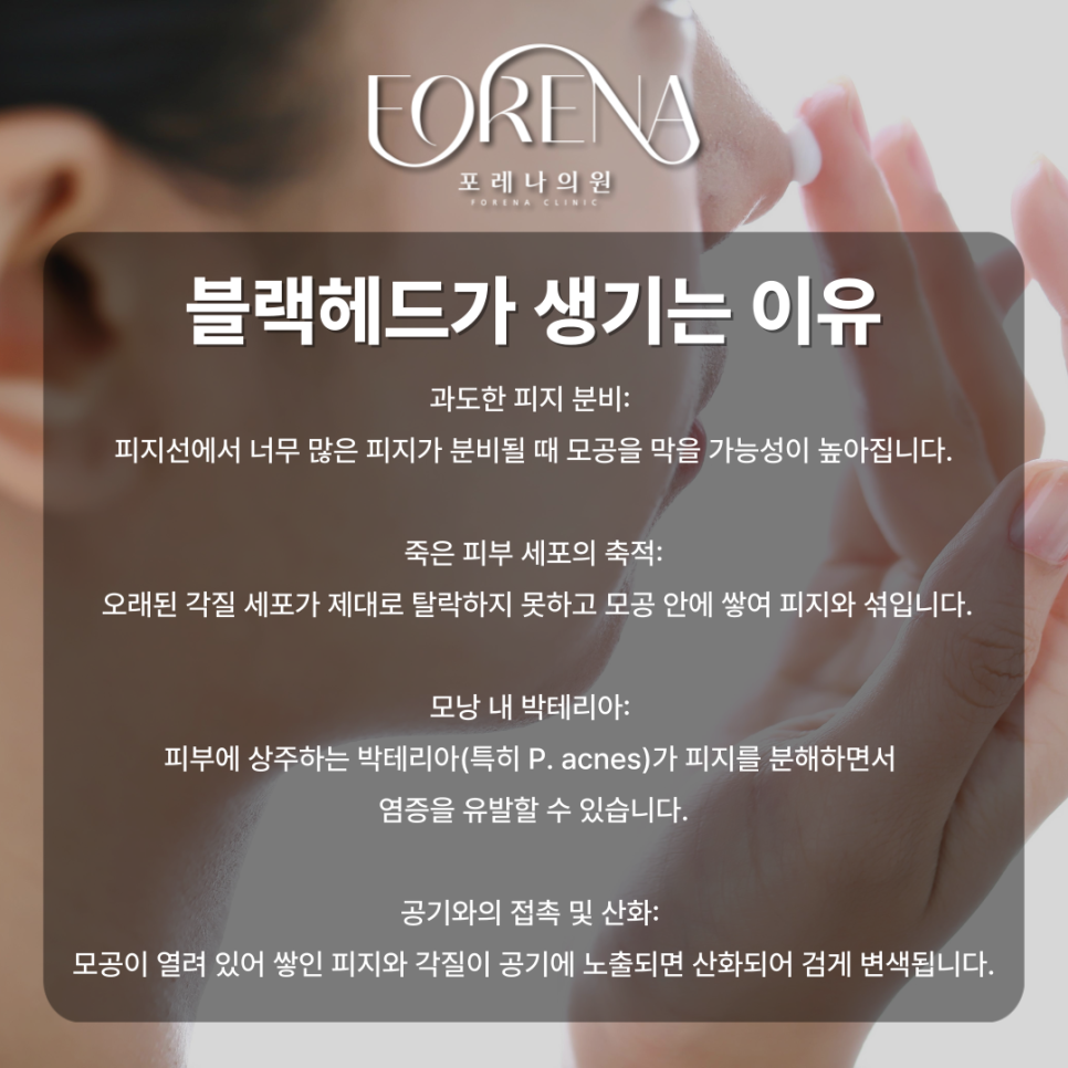 블랙헤드란 무엇인가? 홍대 포레나의원에서 알려드립니다!🤦🏼 관련 이미지 4