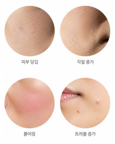 환절기만 되면 피부가 뒤집히는 이유, 알고 계셨나요? [홍대포레나의원] 관련 이미지 3