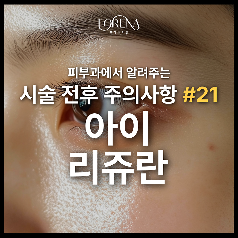 아이리쥬란 피부과에서 상담 받기 전에 보면 좋은 주의사항 관련 이미지 2