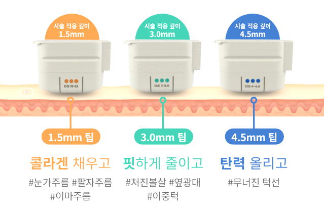 울쎄라피프라임 Q&A | 시술 원리와 특징 정리 관련 이미지 2