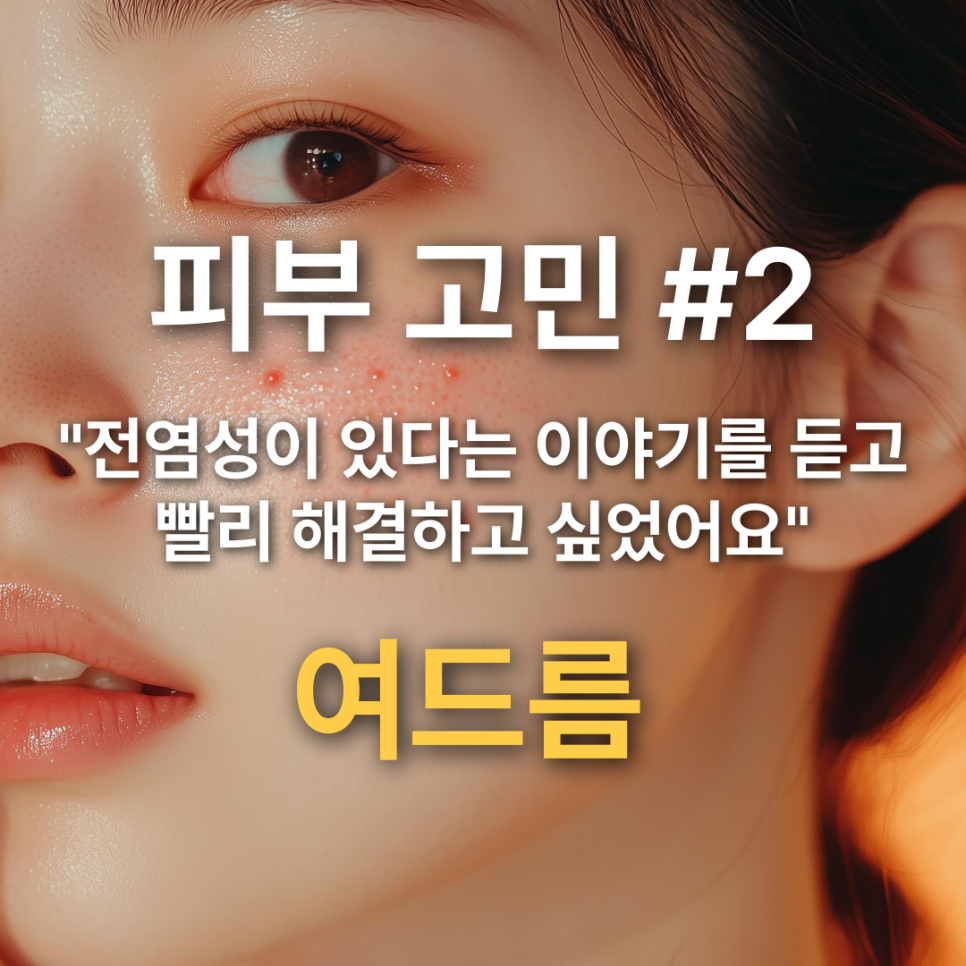 학창시절부터 성인때까지 꾸준하게 나를 괴롭혀온 여드름에 대한 이야기🚨 관련 이미지 2