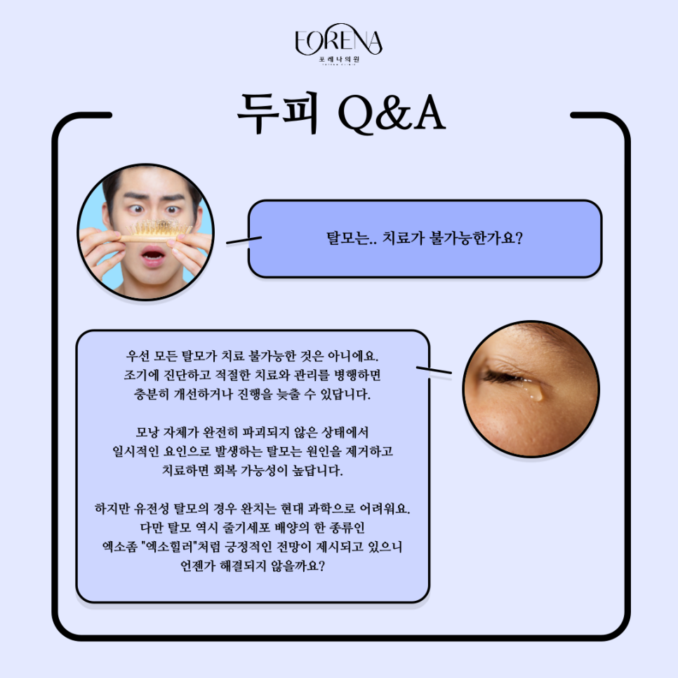 두피도 피부다? 두피에 대한 이야기!! 관련 이미지 6