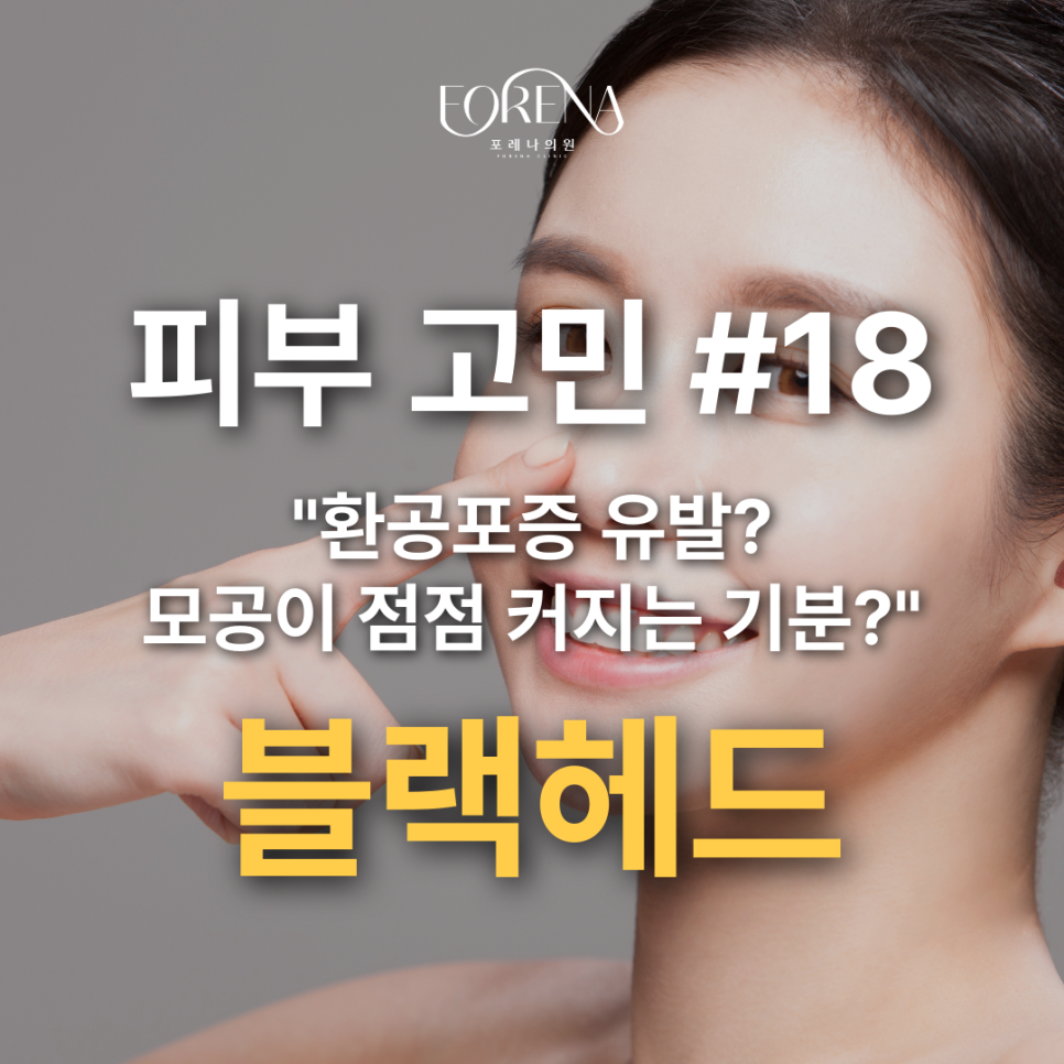 블랙헤드란 무엇인가? 홍대 포레나의원에서 알려드립니다!🤦🏼 관련 이미지 2