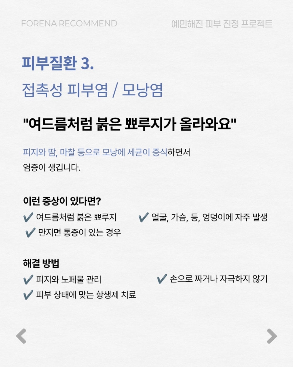 여름철 놓치기 쉬운 관련 이미지 6