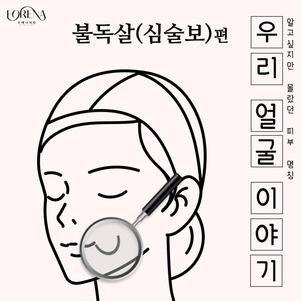 우리가 몰랐던 불독살에 관한 정보들과 이야기들을 알아보자 👀 관련 이미지 2