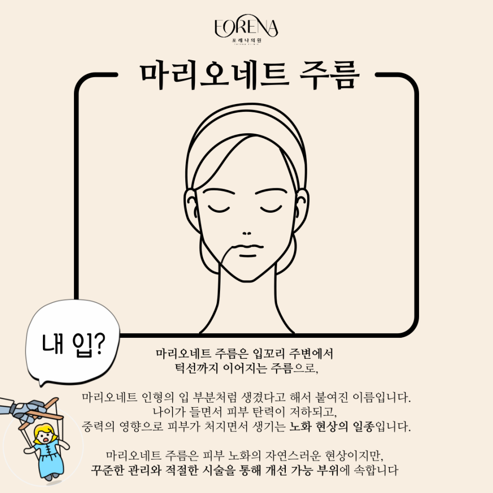 마리오네트 주름을 모르는 분들에게 포레나의원이 설명 드립니다! 👀 관련 이미지 3