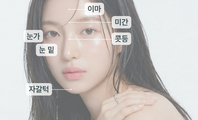 주름보톡스 Q&A | 시술 원리와 특징 정리 관련 이미지 12