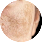 What Makes the Face Look Dull image 4