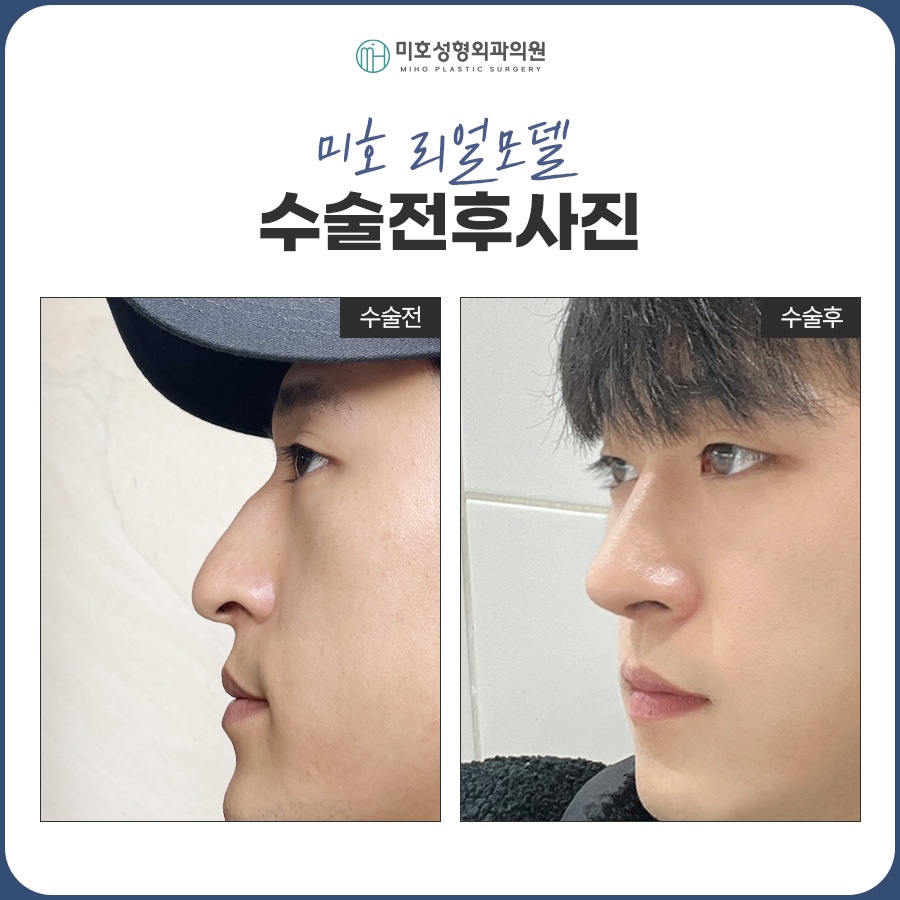남자코 잘 맞는 이미지로 관련 이미지 9