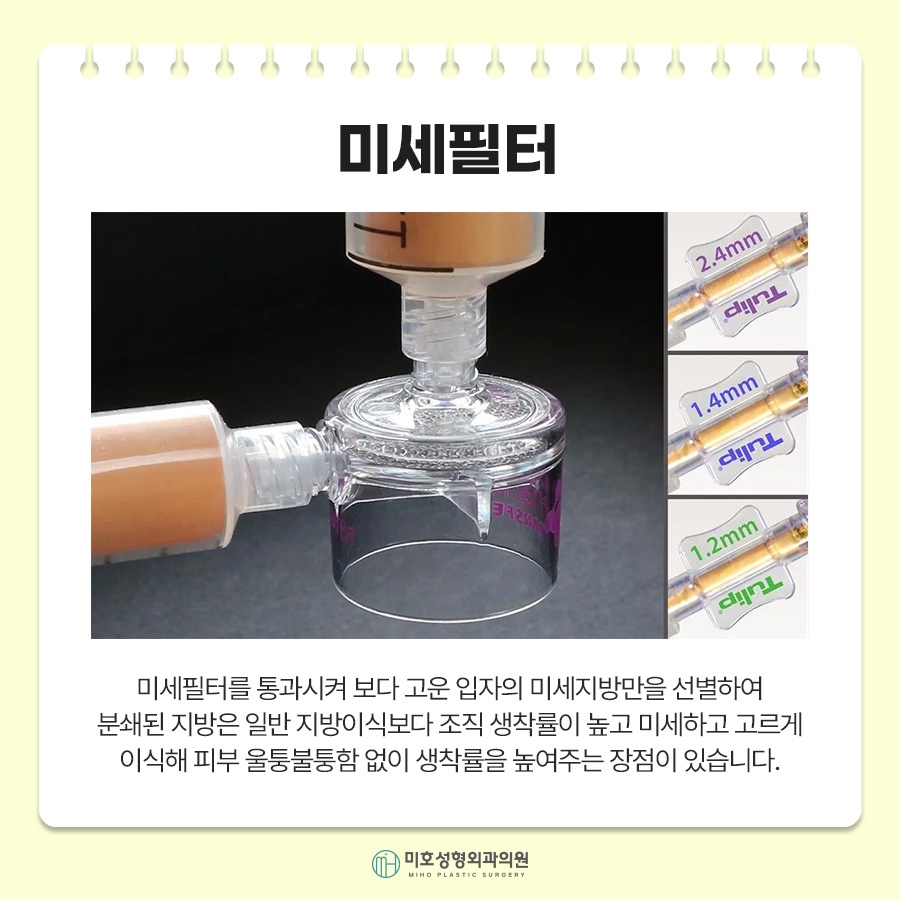 눈밑지방이식 자연스러운 입체감 완성 관련 이미지 3