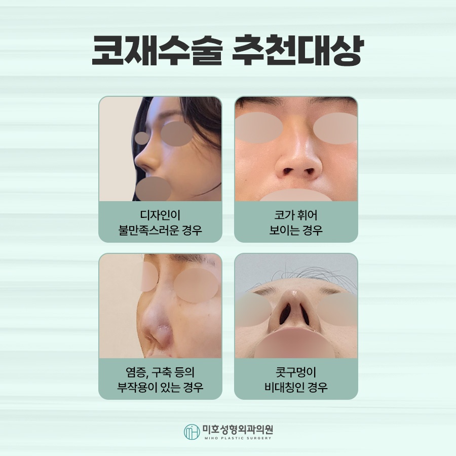 신논현코재수술 체크포인트 관련 이미지 3