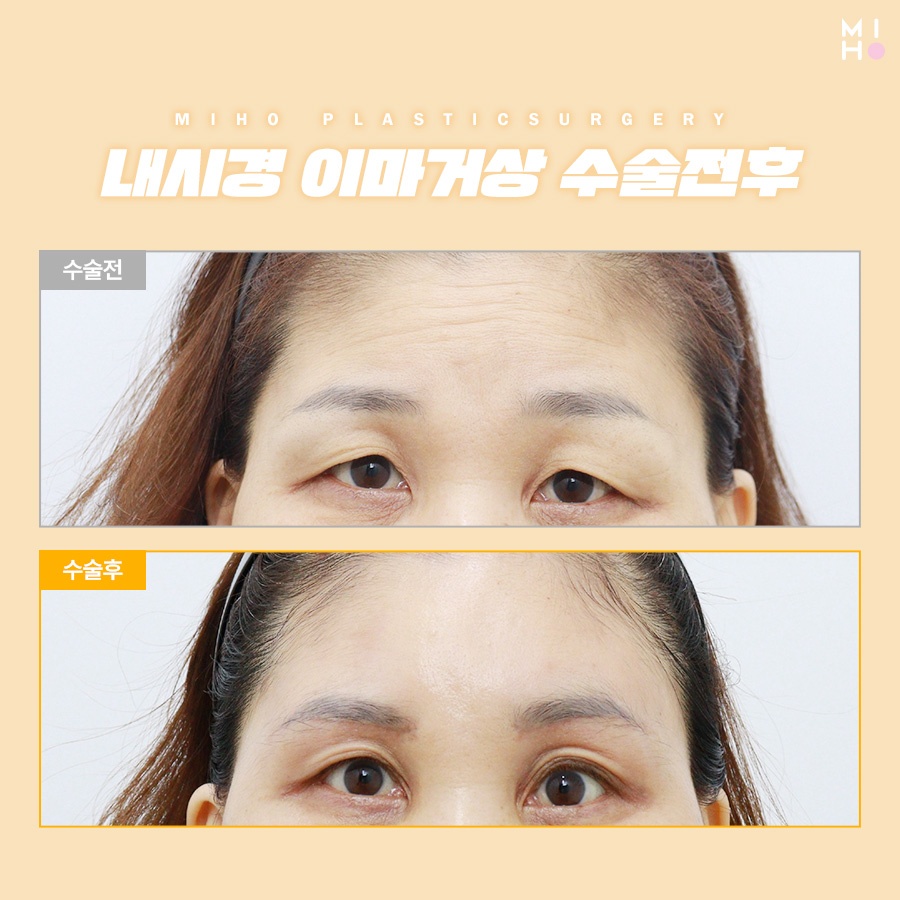 이마거상술후기 고려할 부분은 관련 이미지 7