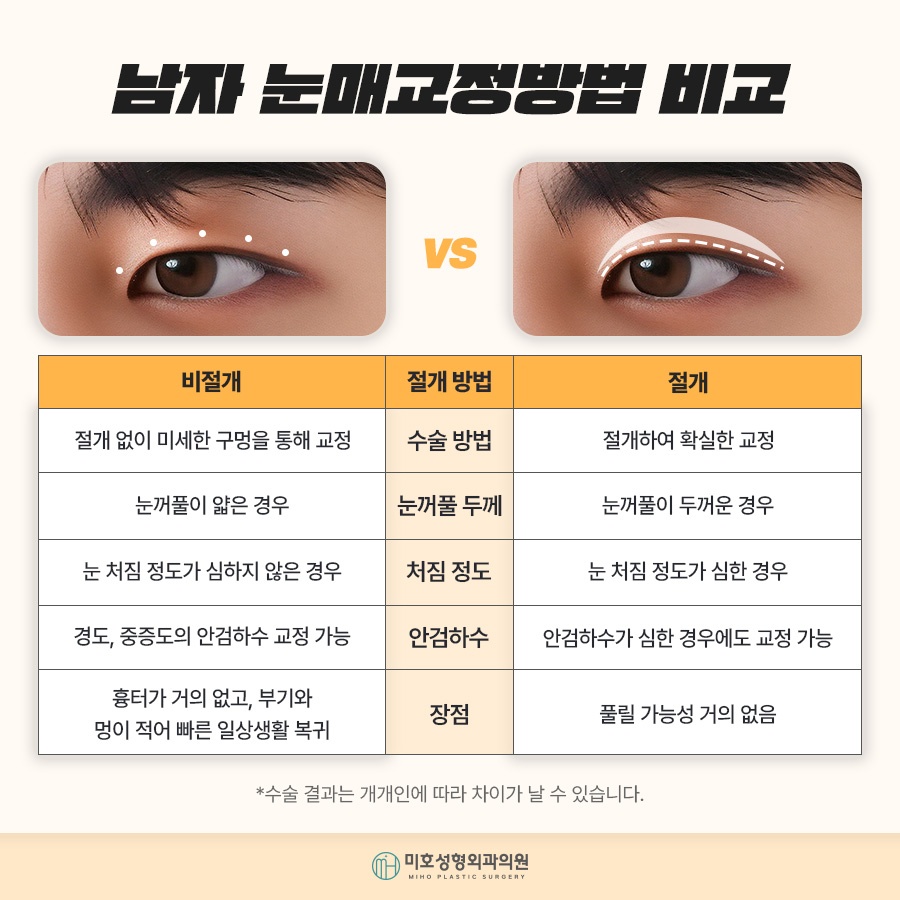 남자눈매교정 자연스러운 이미지로 관련 이미지 3