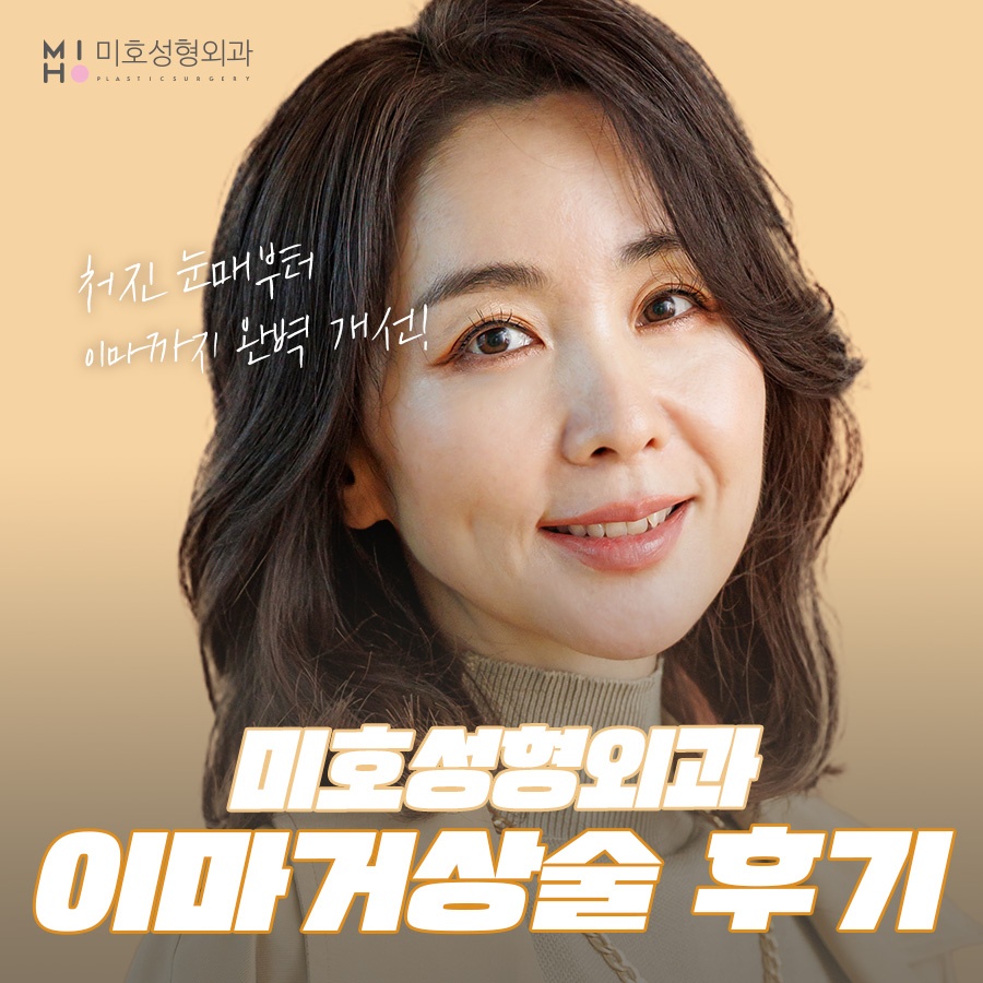 이마거상술후기 고려할 부분은 관련 이미지 1