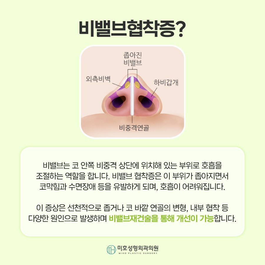 비밸브재건술 기능을 회복시키며 관련 이미지 2
