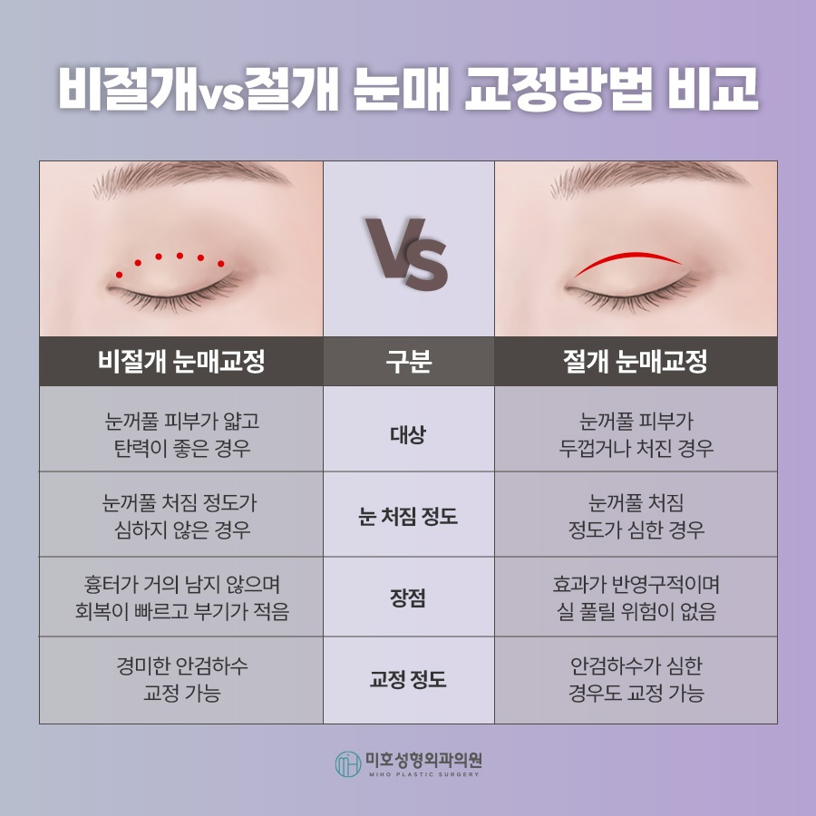 남자안검하수 자연스러움을 바탕으로 관련 이미지 5