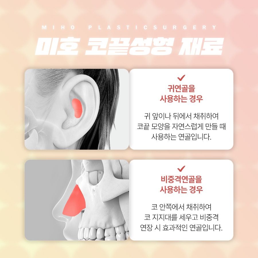 코끝성형 약간의 보완만으로 관련 이미지 4