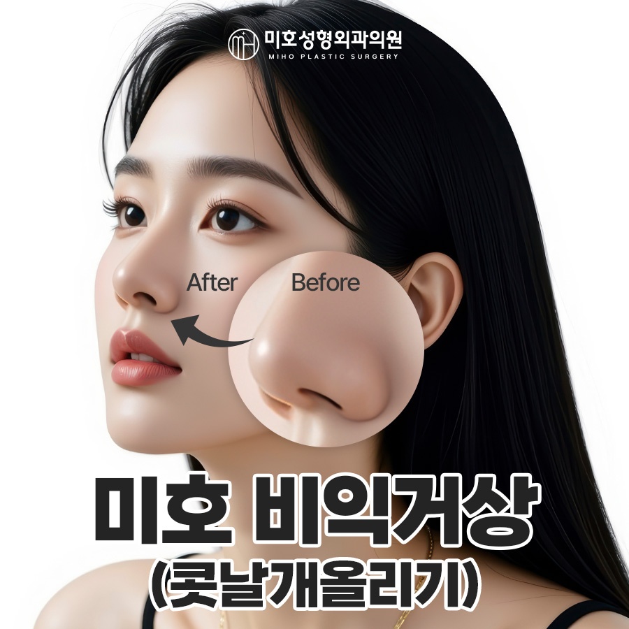 미호 비익거상 자연스러운 콧날개올리기 비율교정! 관련 이미지 1