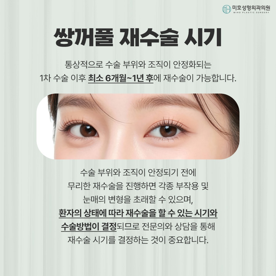 Differences Between One-Line and Two-Line Correction and Causes of Sausage Eyes image 4