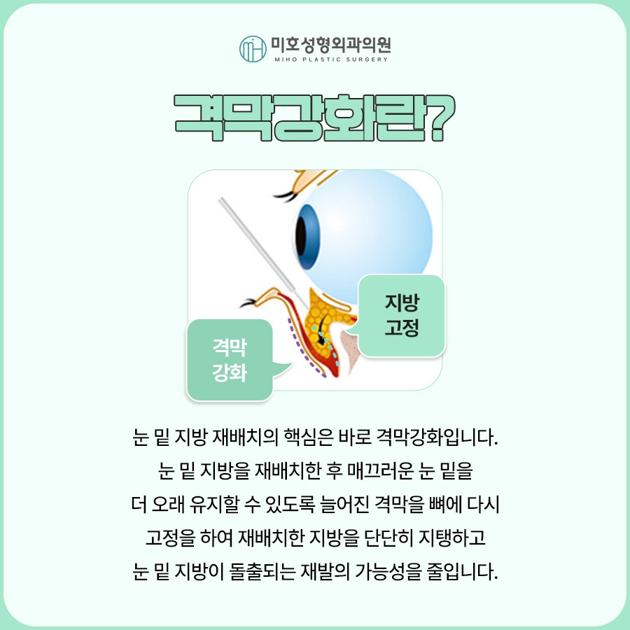 눈밑지 후기보다 의료진 실력이 중요 관련 이미지 4