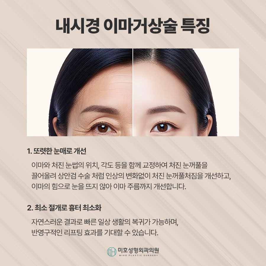 이마거상후기 진행과정 및 체크할 점 관련 이미지 3