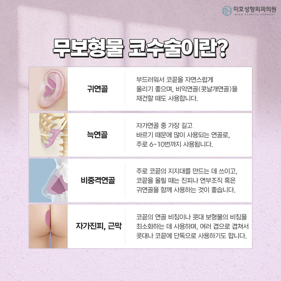 Criteria for Choosing Natural-Looking Implant-Free Rhinoplasty image 4