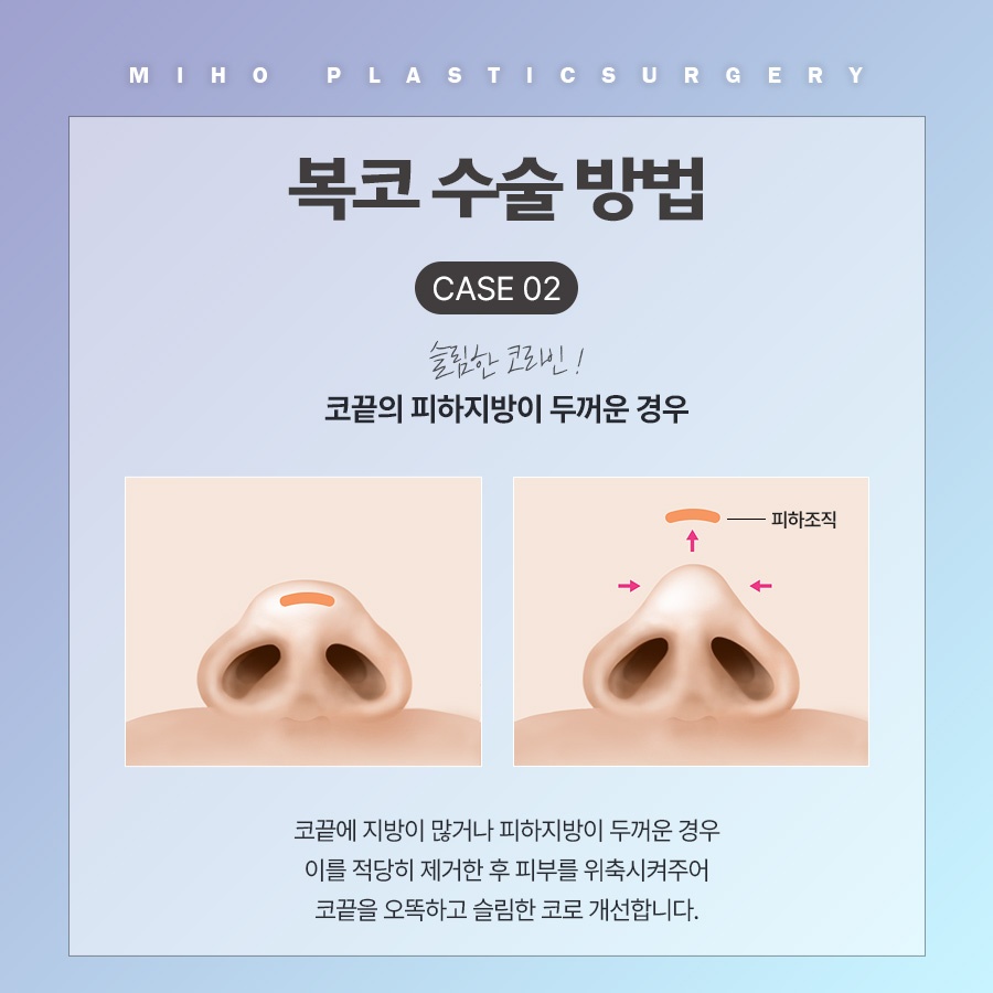복코 교정 관상까지 좋아지려면 관련 이미지 5