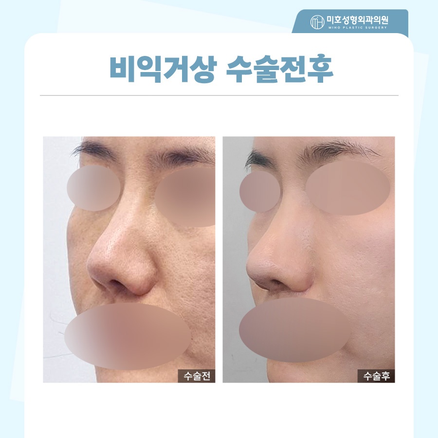 비익거상 개개인별 맞는 비율로 관련 이미지 9