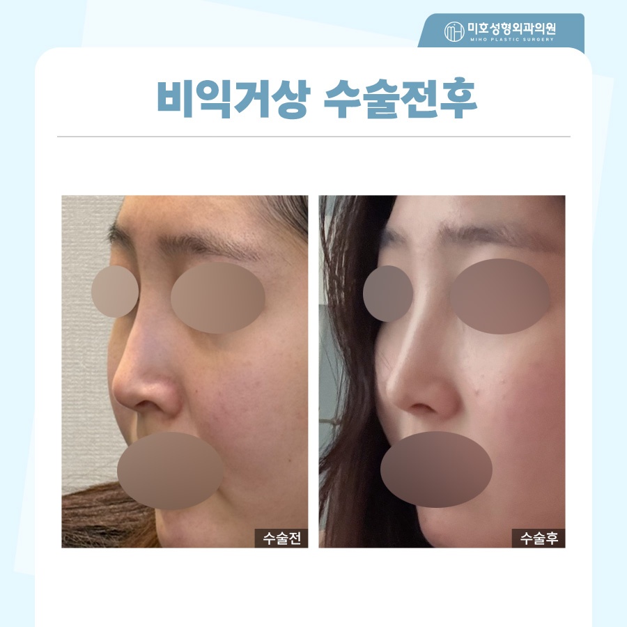 비익거상 개개인별 맞는 비율로 관련 이미지 7
