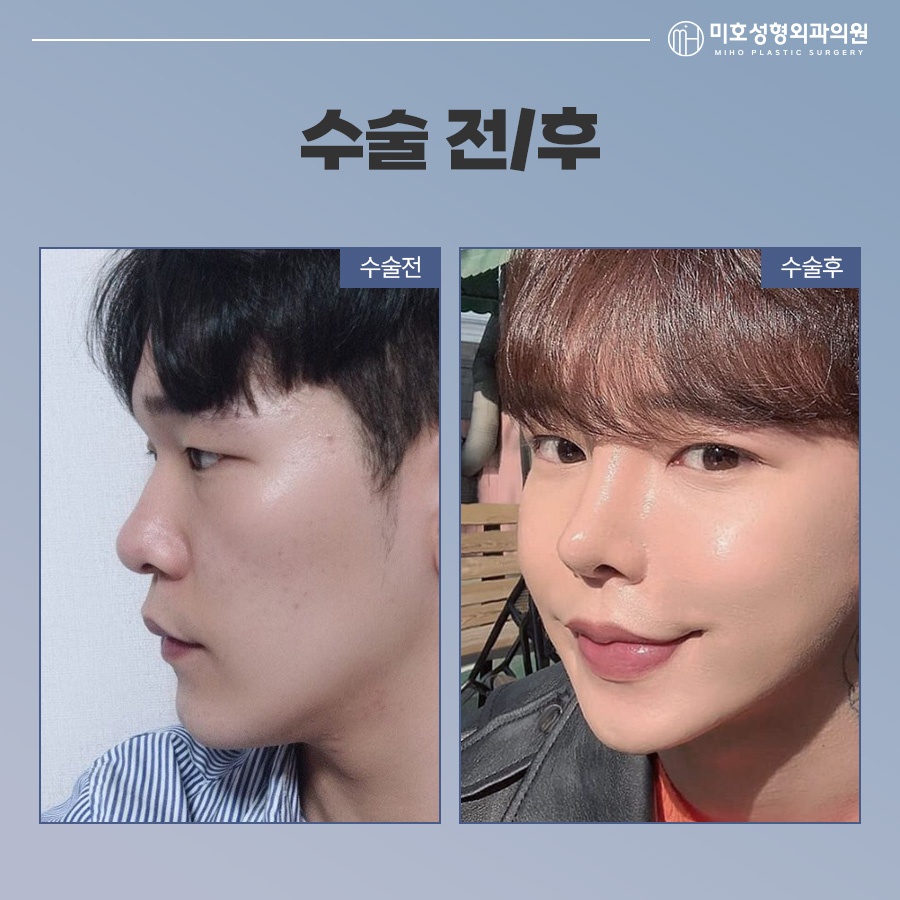 남자코 성별에 따른 차이점을 인지하여 관련 이미지 9