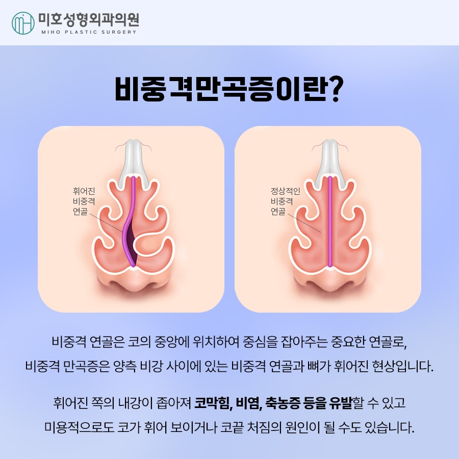 If You Are Looking for Ways to Improve Septal Deviation and Rhinitis Surgery image 2