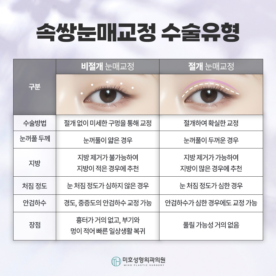 속쌍눈매교정에 관심을 두고 있다면 관련 이미지 4