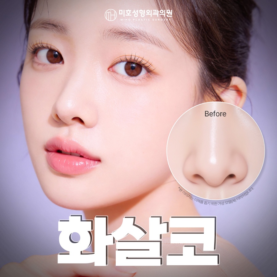 화살코 교정 방법 및 관리수칙 관련 이미지 1