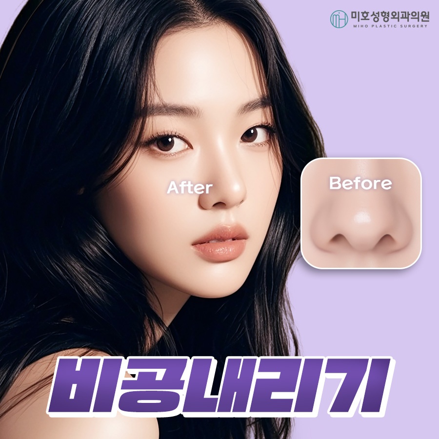 비공내리기 올바른 용코 교정은 관련 이미지 1
