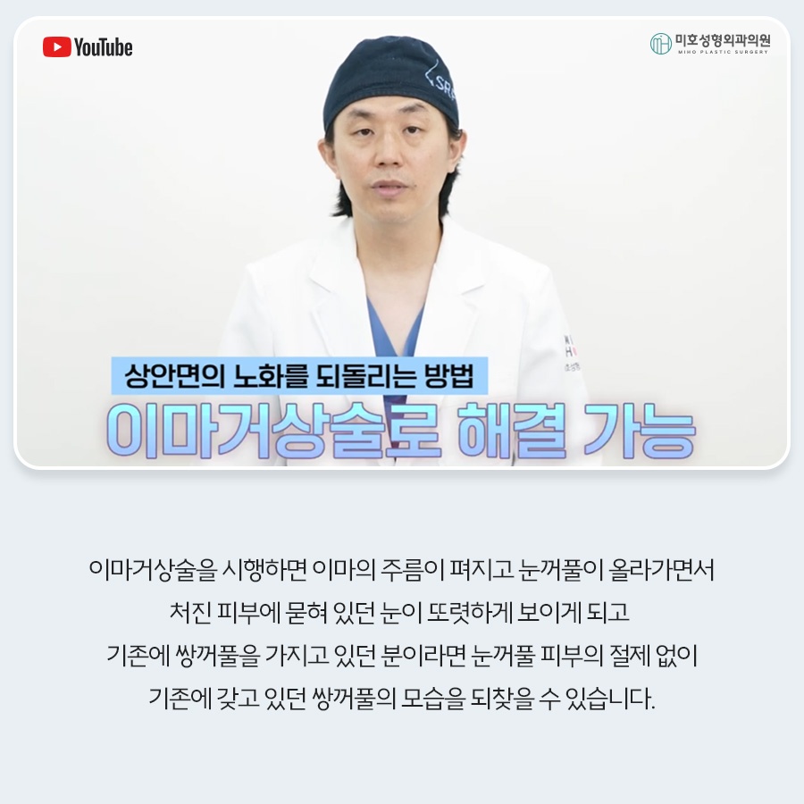 이마거상비용 방법 비교 관련 이미지 5