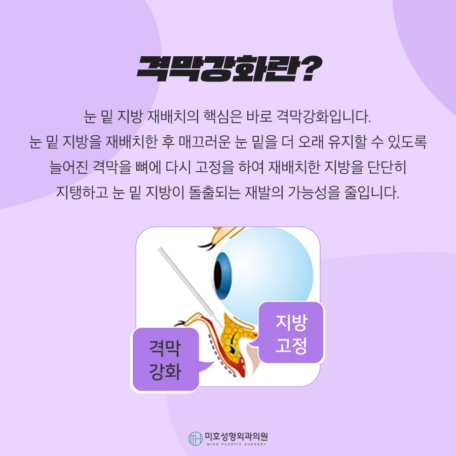 눈밑지방재배치로 젊음을 획득 관련 이미지 4