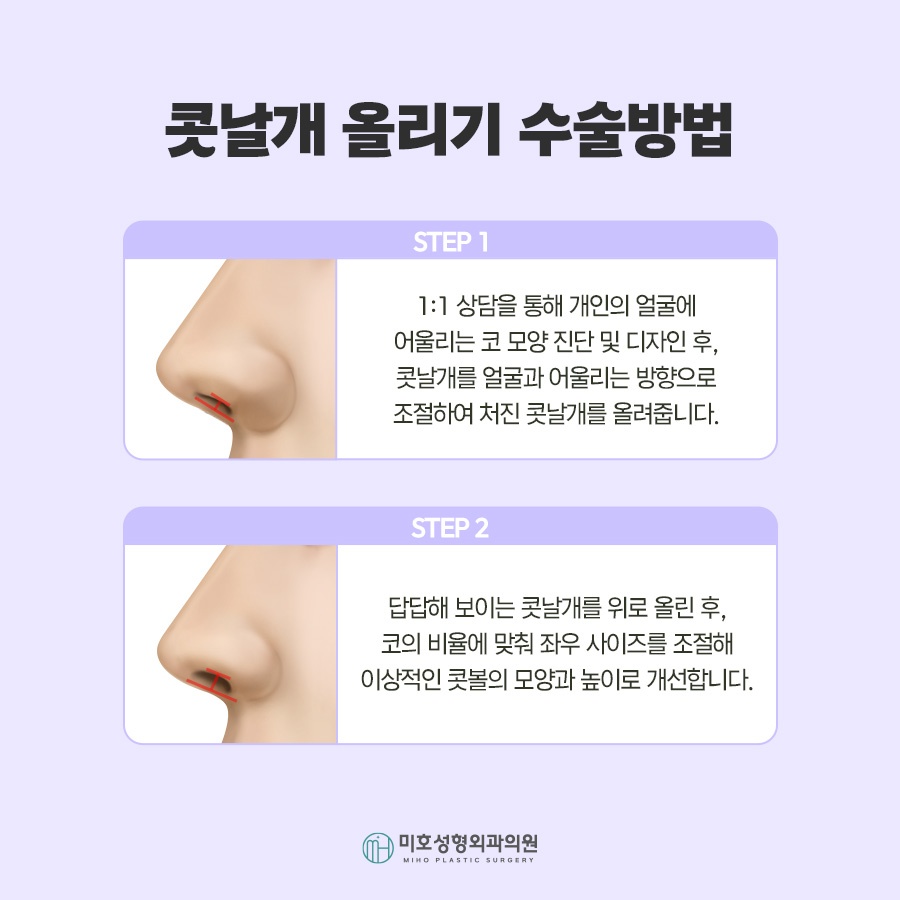 콧날개올리기 비익거상 기준 살펴보고 관련 이미지 5