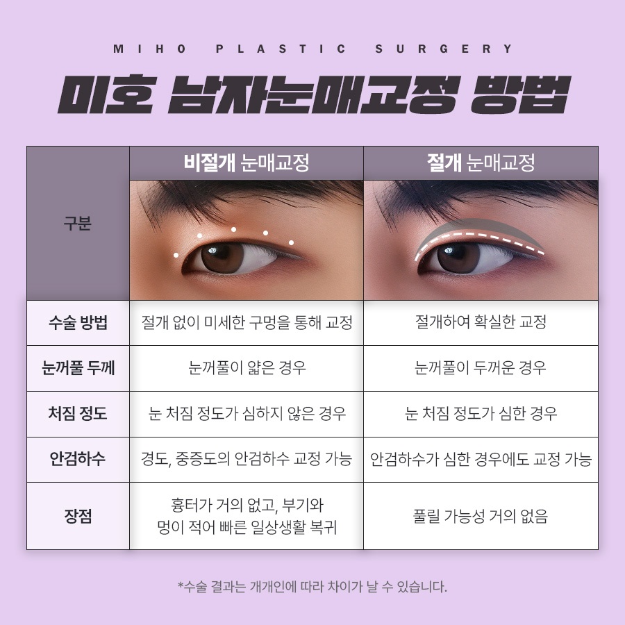 The Key to a Natural Image Transformation with Male Eyelid Surgery image 3
