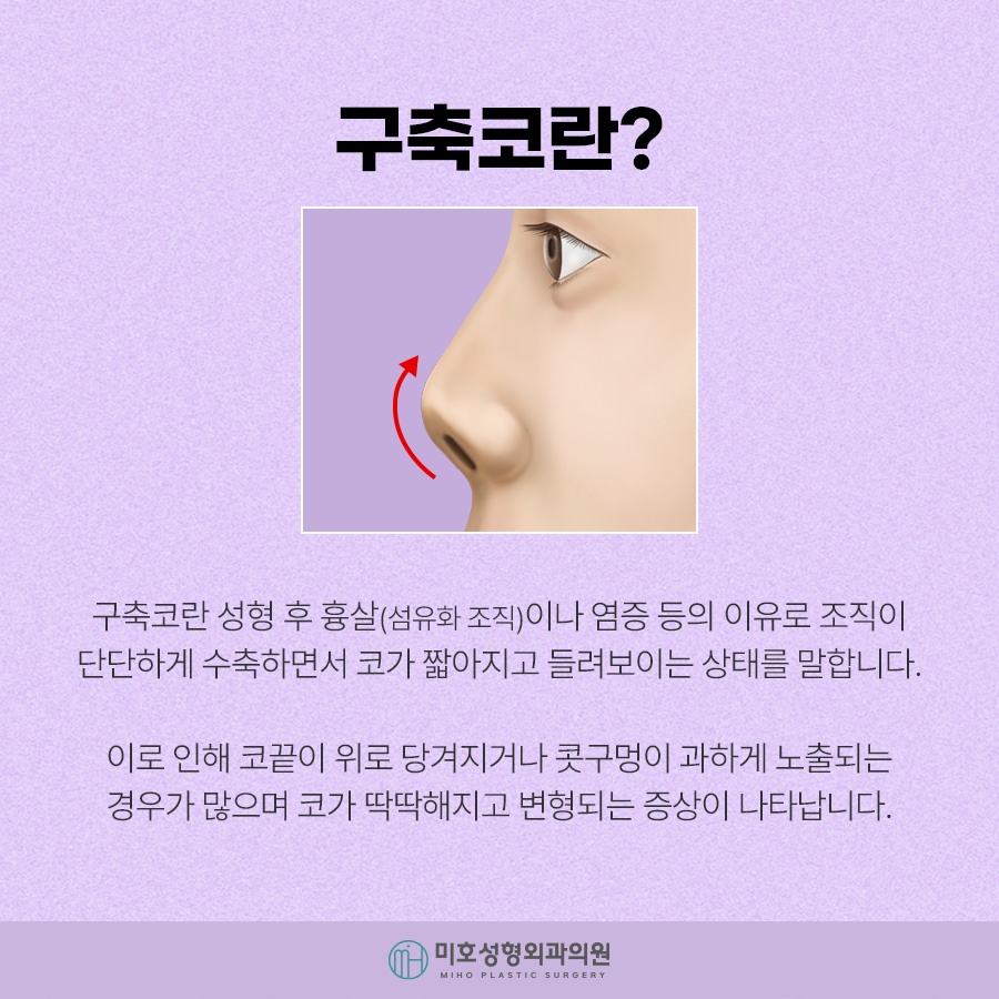 구축코 재시도 신중히 고려하여 관련 이미지 2