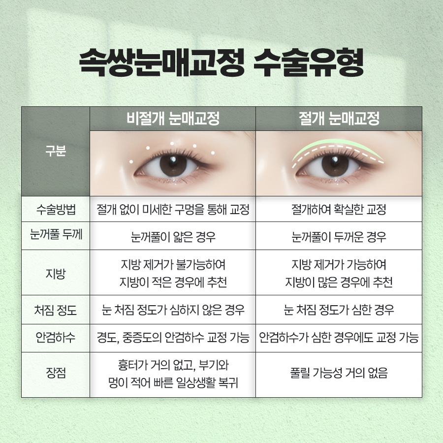 속쌍눈매교정 또렷한 눈매를 원할때 관련 이미지 4