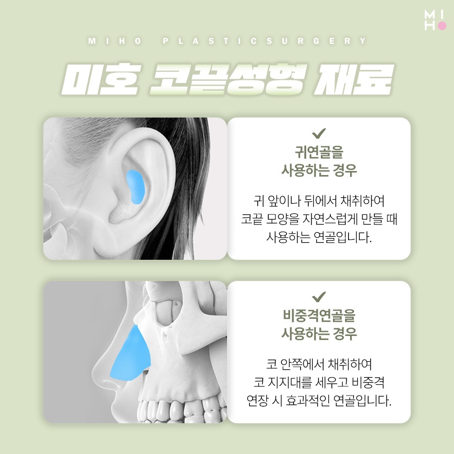 코끝성형 오똑하고 자연스럽게 관련 이미지 3