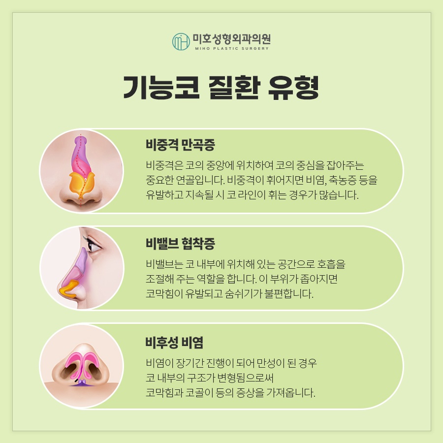 기능코 편안하고 아름다운 비결 관련 이미지 3