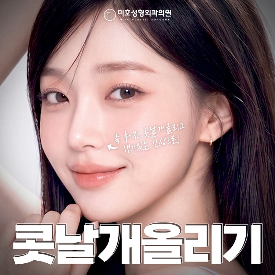콧날개올리기 처진 코 교정 관련 이미지 1