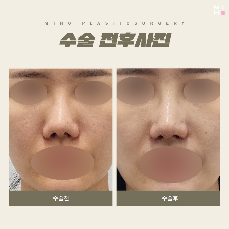 비익거상 깔끔한 과정을 위해서 관련 이미지 10
