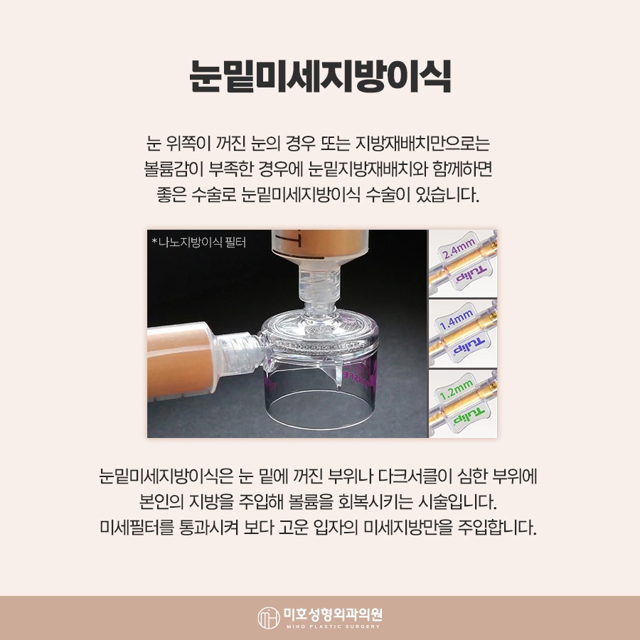 눈밑지방재배치수술후 회복 흐름 살펴봐야 관련 이미지 6