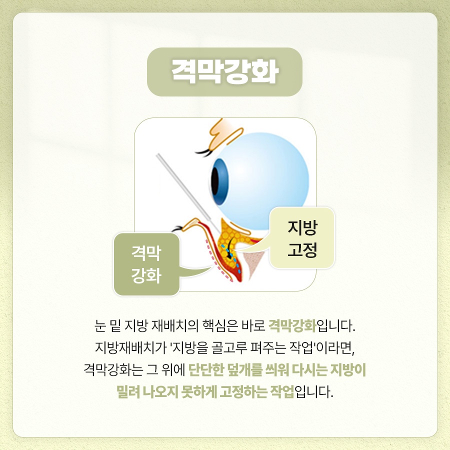 눈밑지방재배치 피로한 인상을 관련 이미지 4